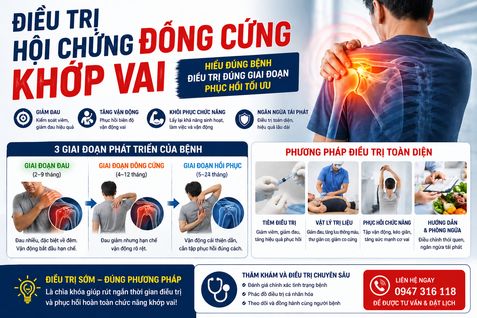 HỘI CHỨNG ĐÔNG CỨNG KHỚP VAI